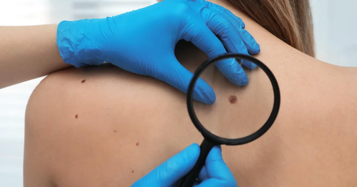 Dermatologists