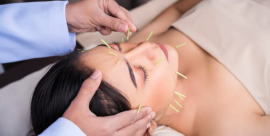 Acupuncturists