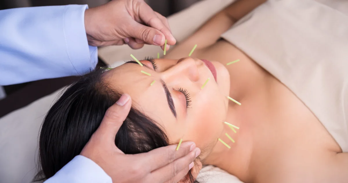 Acupuncturists