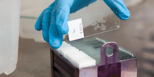 Histotechnologists and histologic technicians