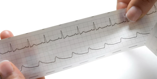 Cardiovascular technologists and technicians