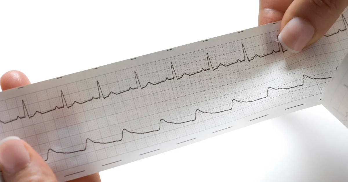Cardiovascular technologists and technicians